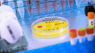 أول إصابة بشرية بسلالة H5N5 من إنفلونزا الطيور تُسجَّل في أمريكا 6 999 183